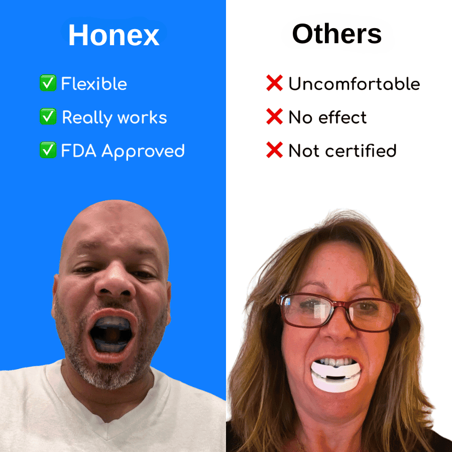 The Quiet Anti-Snoring Mouthpiece Universal Size 50% OFF Today