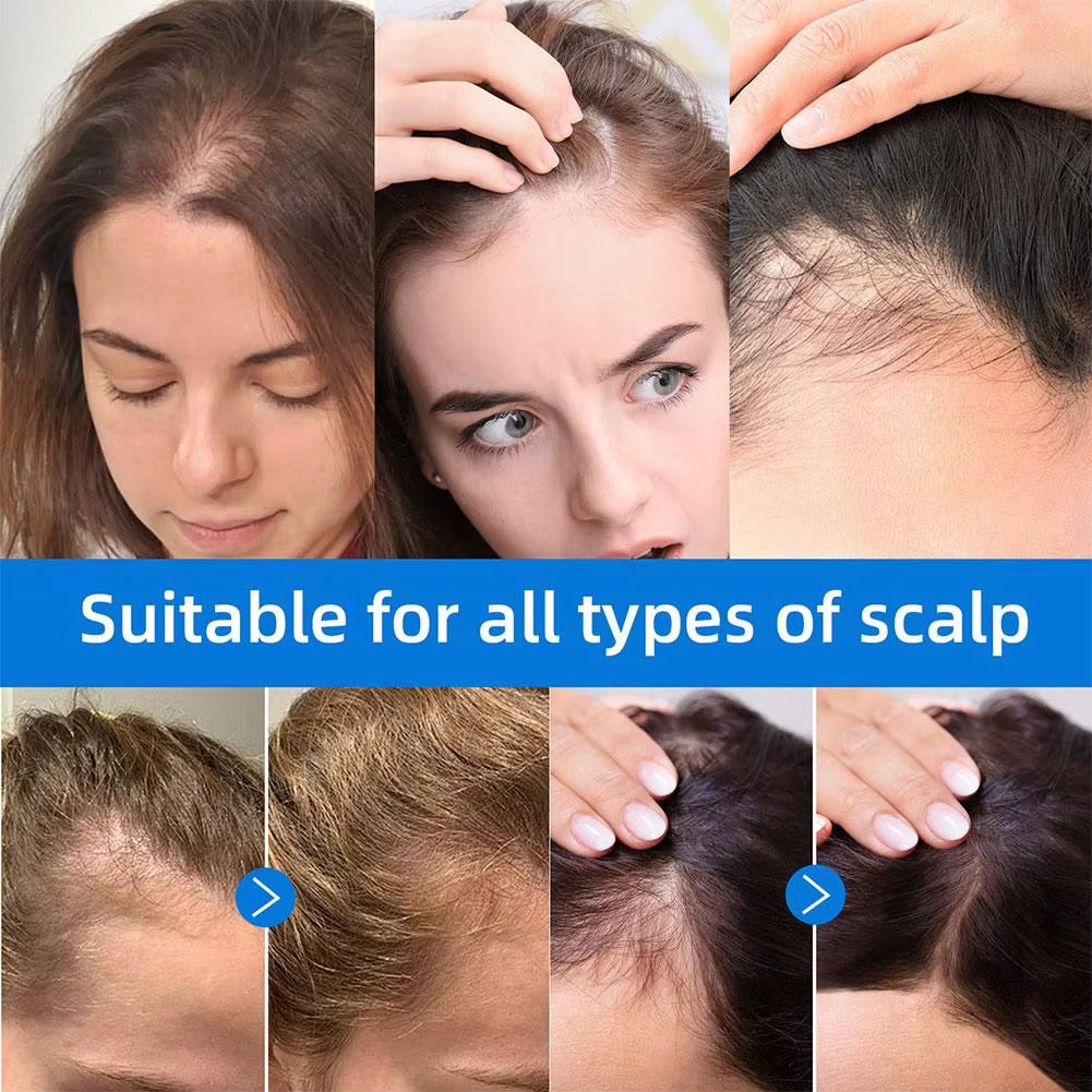 Seapuri Scalpy Hair Growth Serum For Men & Women For Hair Loss & Thinning