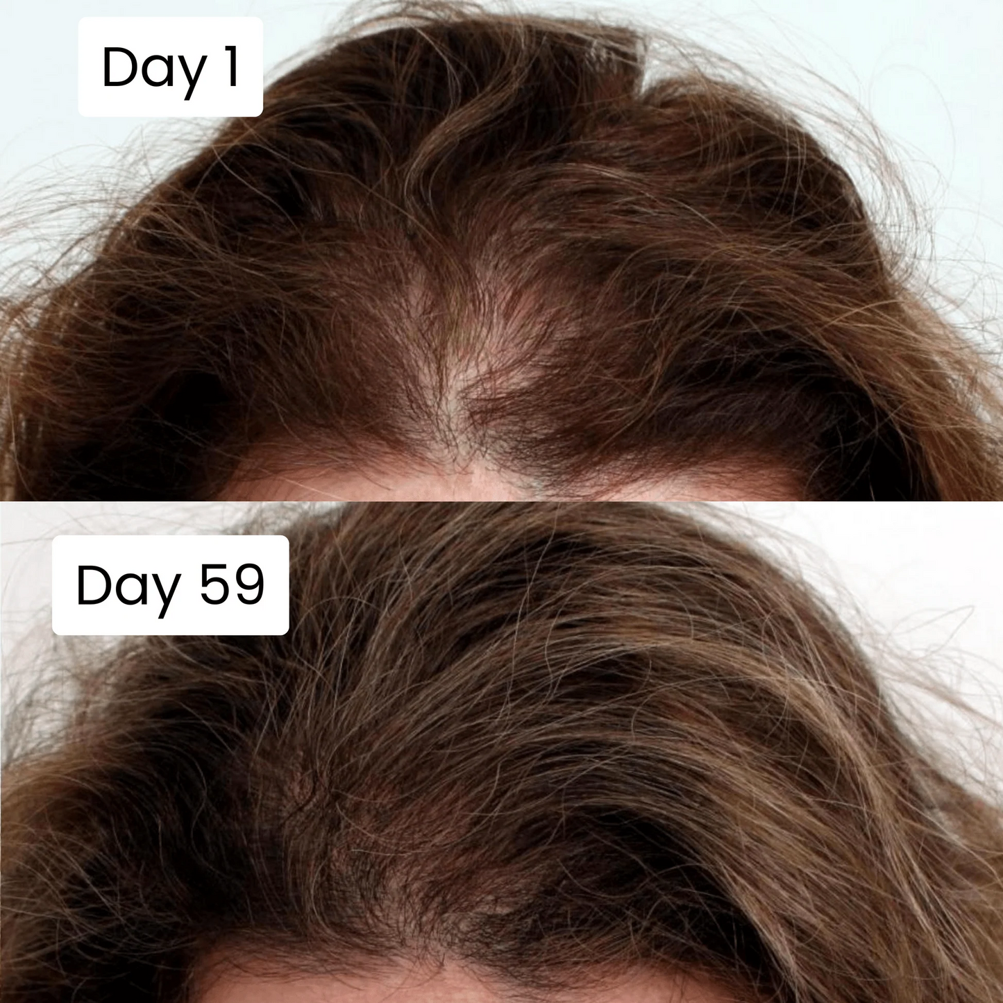 Scalpy Hair Growth Serum Original Free Home Delivery All Over UAE