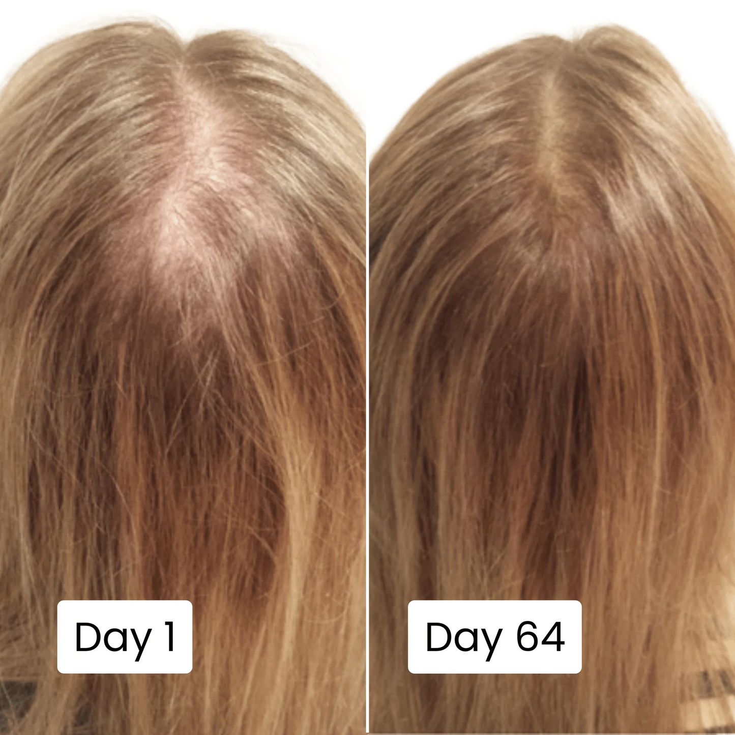 Scalpy Hair Growth Serum Original Free Home Delivery All Over UAE