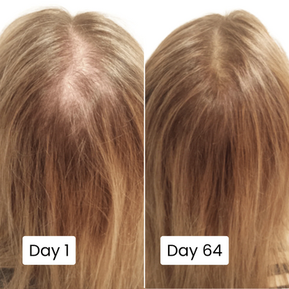 Scalpy Hair Growth Serum Original Free Home Delivery All Over UAE