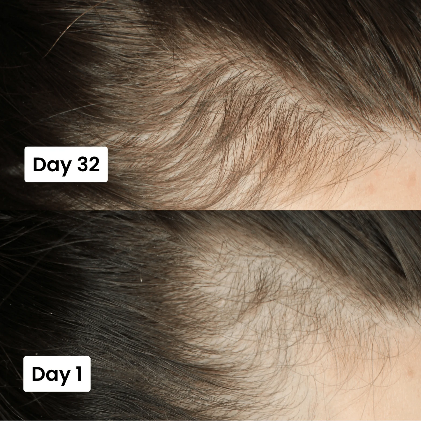 Scalpy Hair Growth Serum Original Free Home Delivery All Over UAE