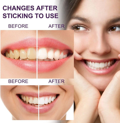 Color Corrector Toothpaste, 50ml Color Corrector Toothpaste For Teeth Whitening, Color Corrector For Correct Yellow Toothpaste For Teeth Cleaning Stain, 1